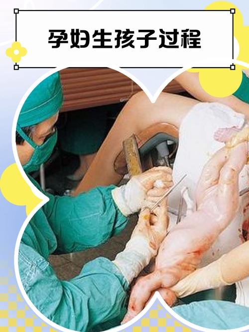 子宫切除了可以代生嘛_子宫切除了还可以做婴儿试管吗_子宫切除还能代孕吗