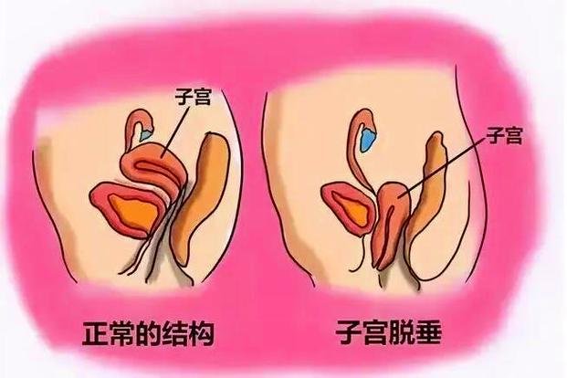 代孕费用_代孕费用_代孕费用