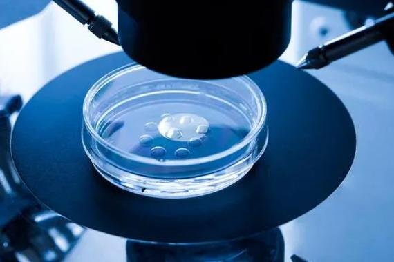 赴格鲁吉亚试管助孕最新攻略:签证、医院、回国手续全覆盖_格鲁吉亚签证政策_格鲁吉亚旅游签证